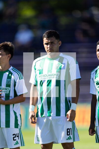 20260228 | Albion vs. Racing – _EOP7873