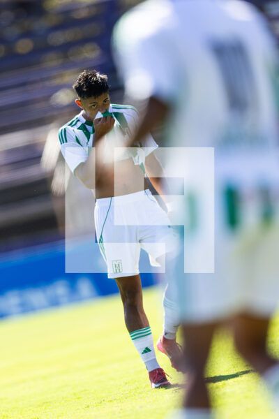 20260228 | Albion vs. Racing – _EOP8157